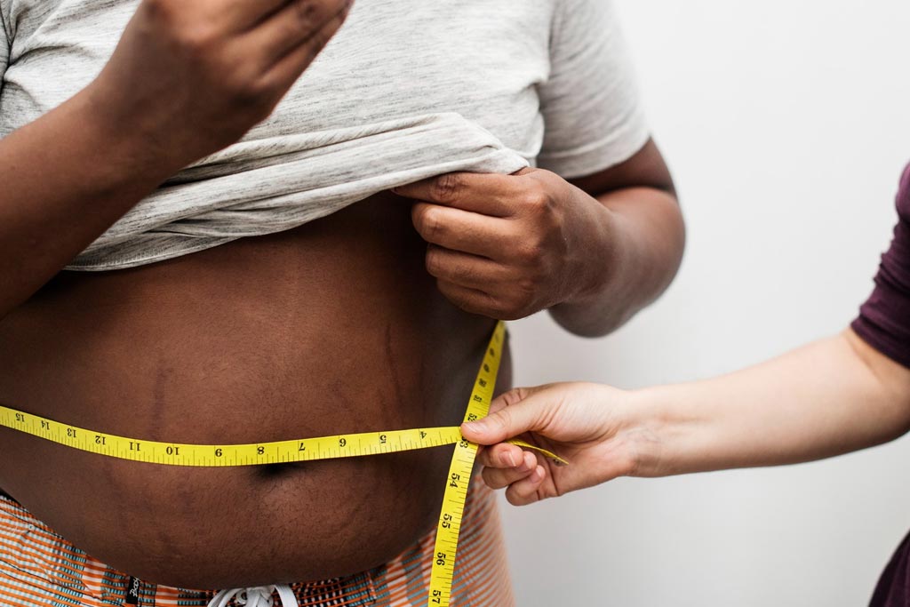 Weight Loss Services